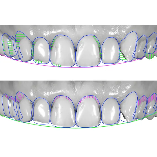 Estudio facial para diseño digital de sonrisas