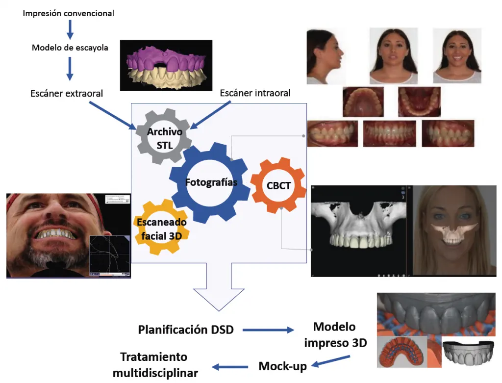 Mock-up de diseño de sonrisa en Córdoba