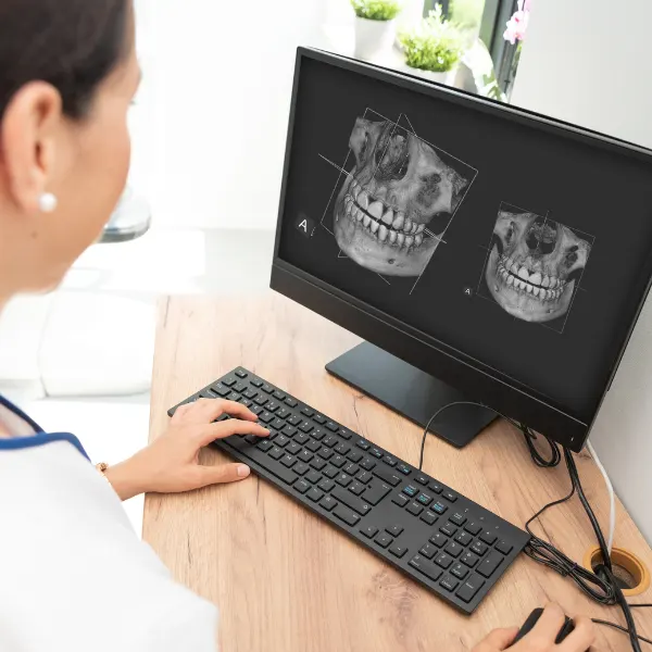 Diagnóstico con TAC 3D para implantes dentales en Córdoba